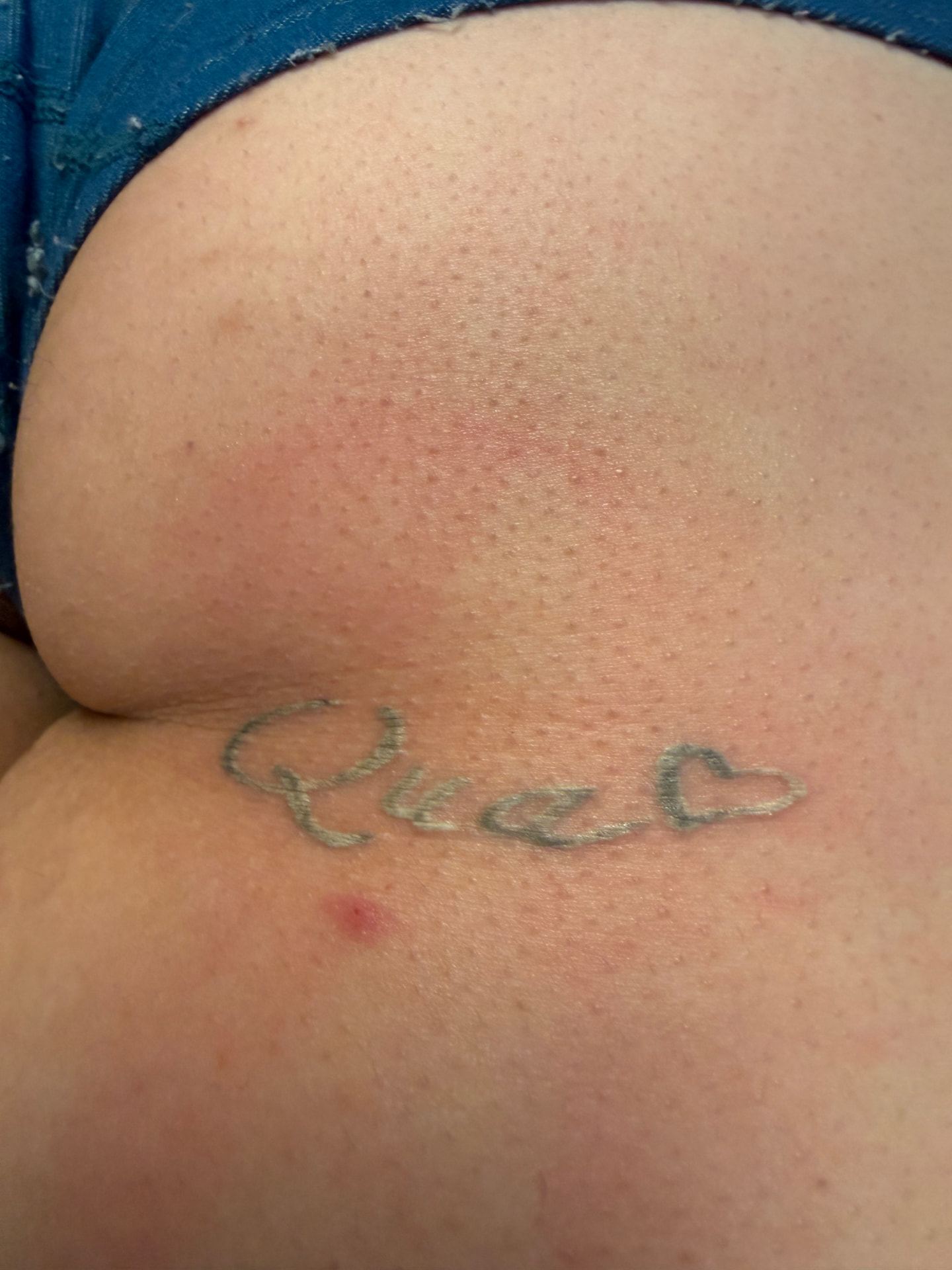 Script tattoo fading after laser sessions