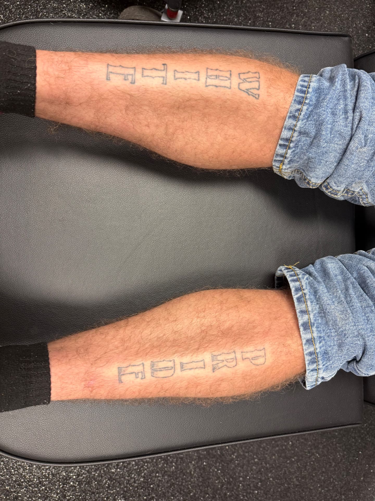 Forearm lettering tattoos fading after laser sessions